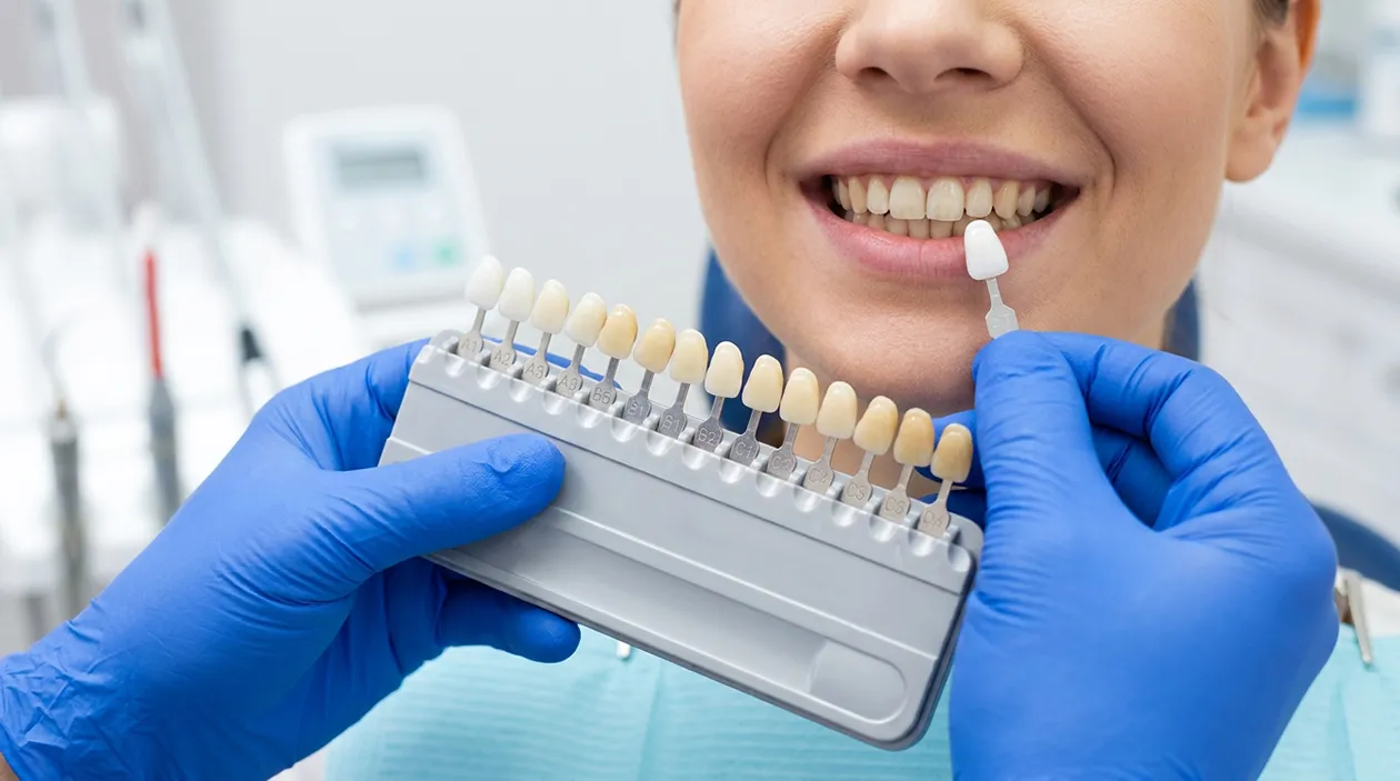 How-long-teeth-whitening-last